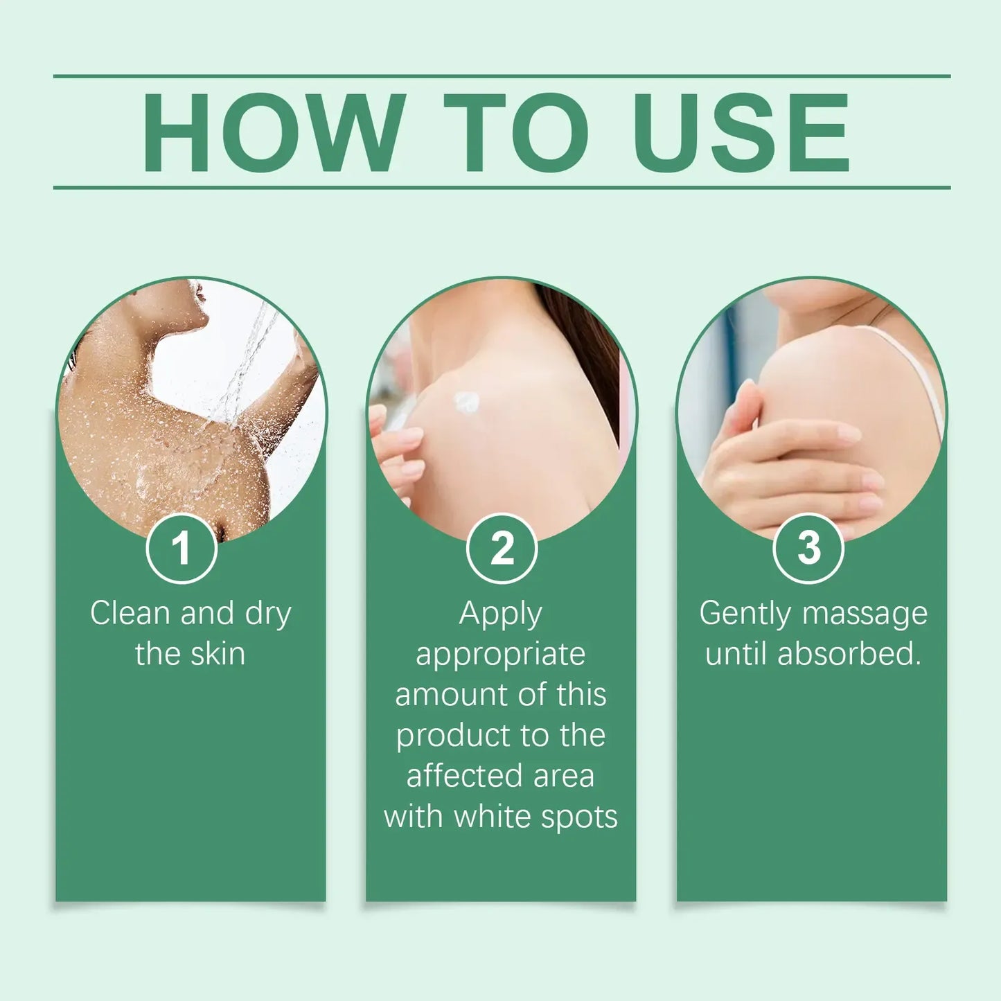 Vitiligo Treatment Cream, Improve Skin Pigmentation, Natural Formula, Suitable for All Skin