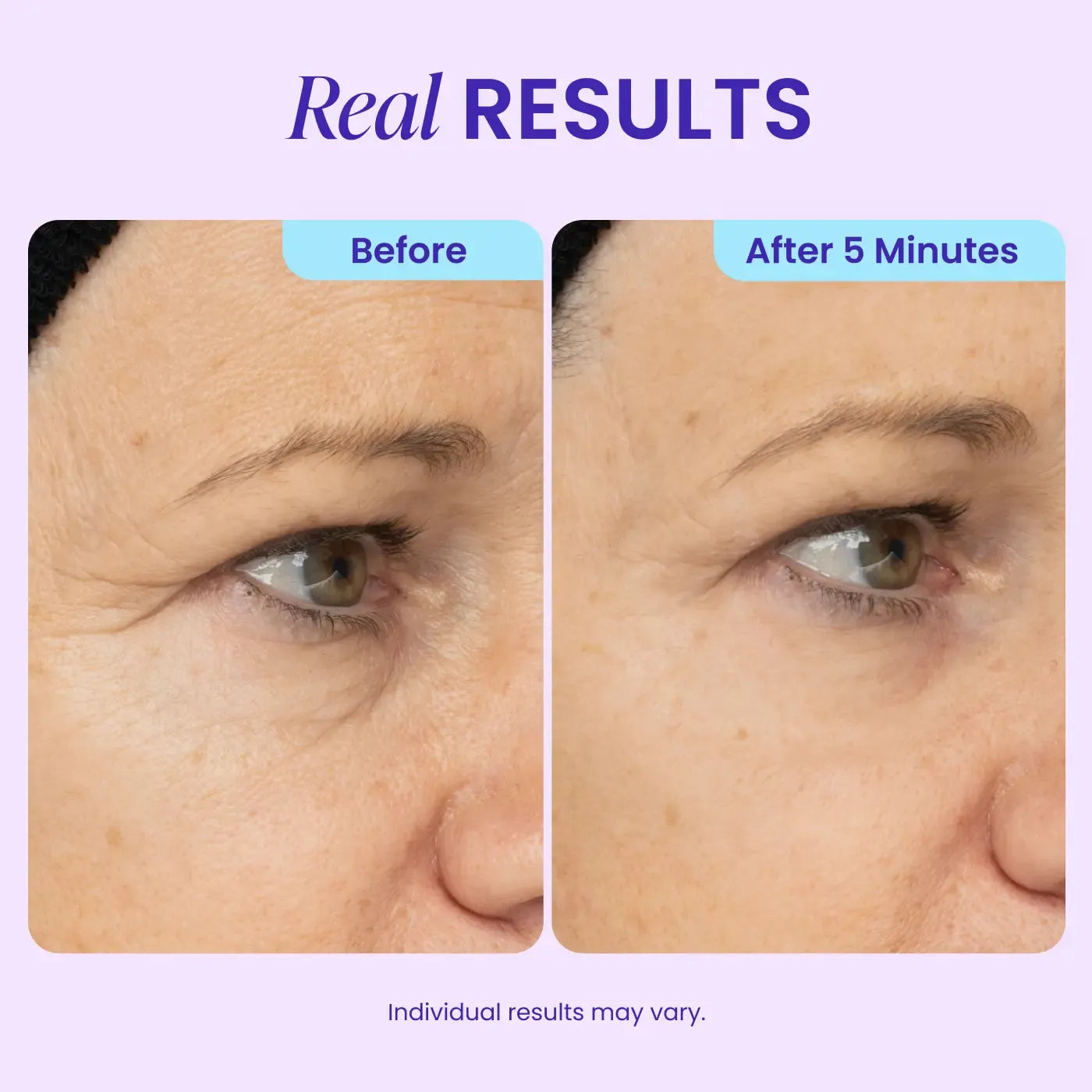 Instant Lift Eye Gel - For the look of Puffiness & Bags, Wrinkles, Fine Lines and Dark Circles