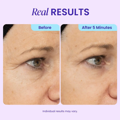 Instant Lift Eye Gel - For the look of Puffiness & Bags, Wrinkles, Fine Lines and Dark Circles