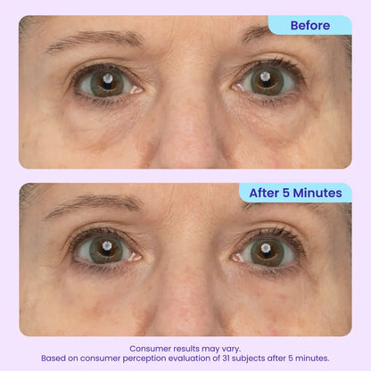 Instant Lift Eye Gel - For the look of Puffiness & Bags, Wrinkles, Fine Lines and Dark Circles