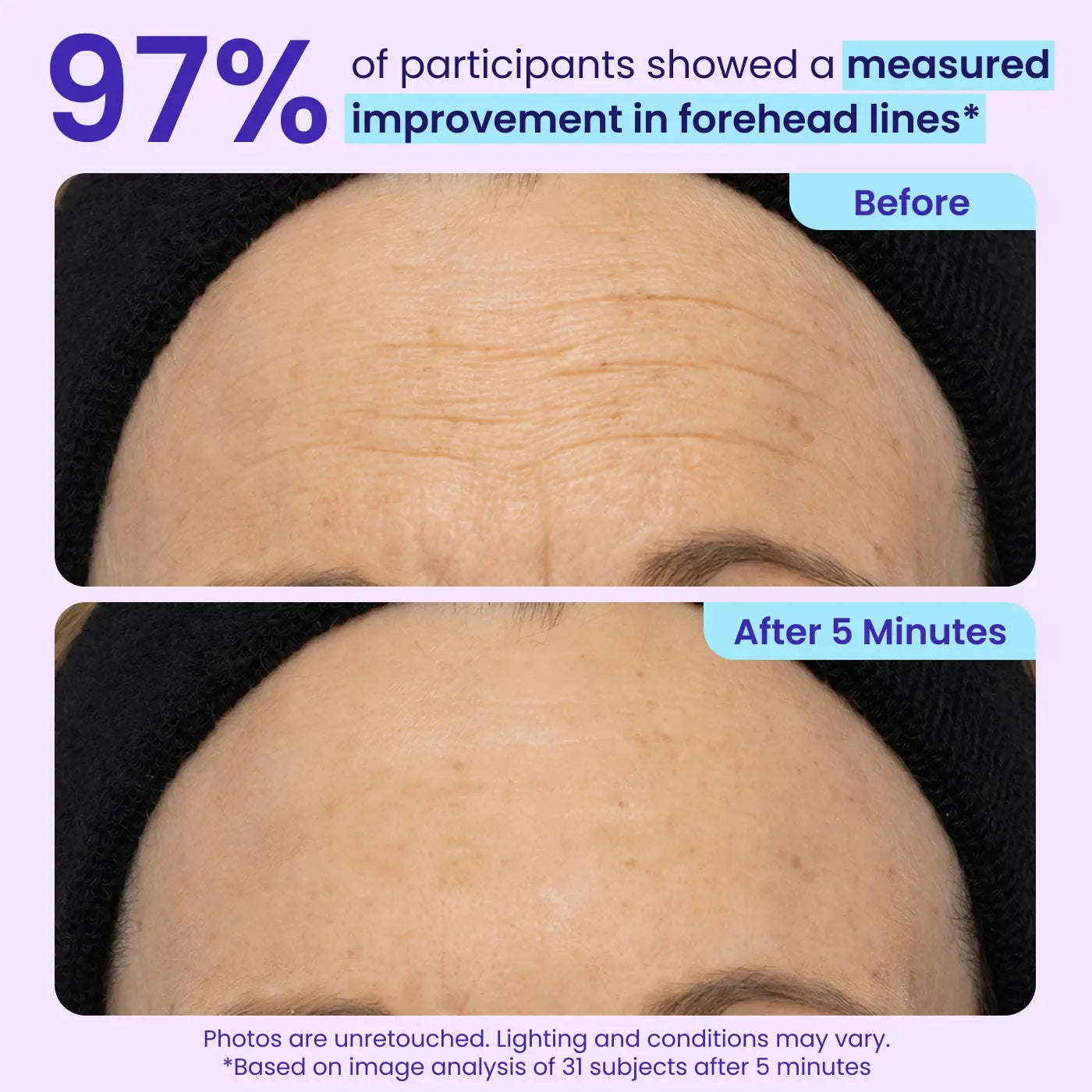 Instant Lift Eye Gel - For the look of Puffiness & Bags, Wrinkles, Fine Lines and Dark Circles