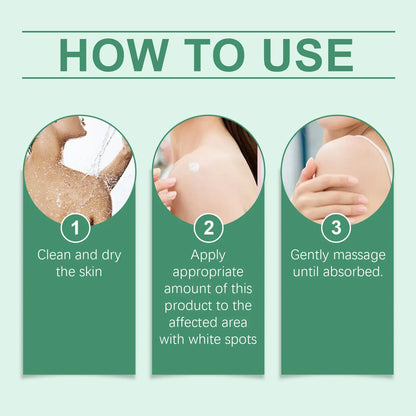 Vitiligo Treatment Cream, Improve Skin Pigmentation, Natural Formula, Suitable for All Skin