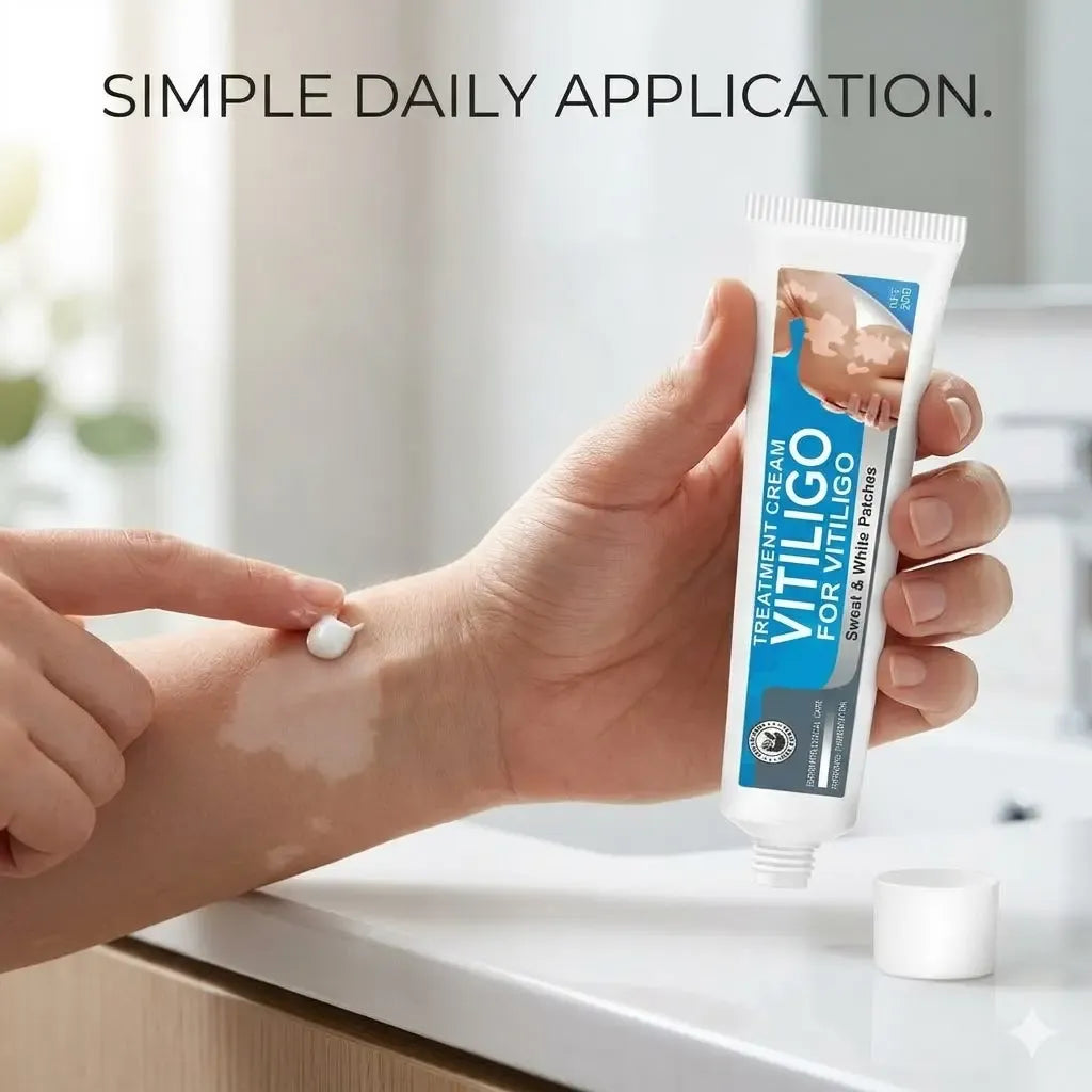 Vitiligo Cream, Natural Effective Vitiligo Treatment for Reduce White Spots and Improve Skin Pigmentation