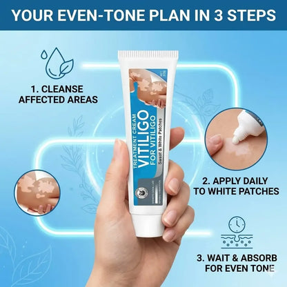 Vitiligo Cream, Natural Effective Vitiligo Treatment for Reduce White Spots and Improve Skin Pigmentation